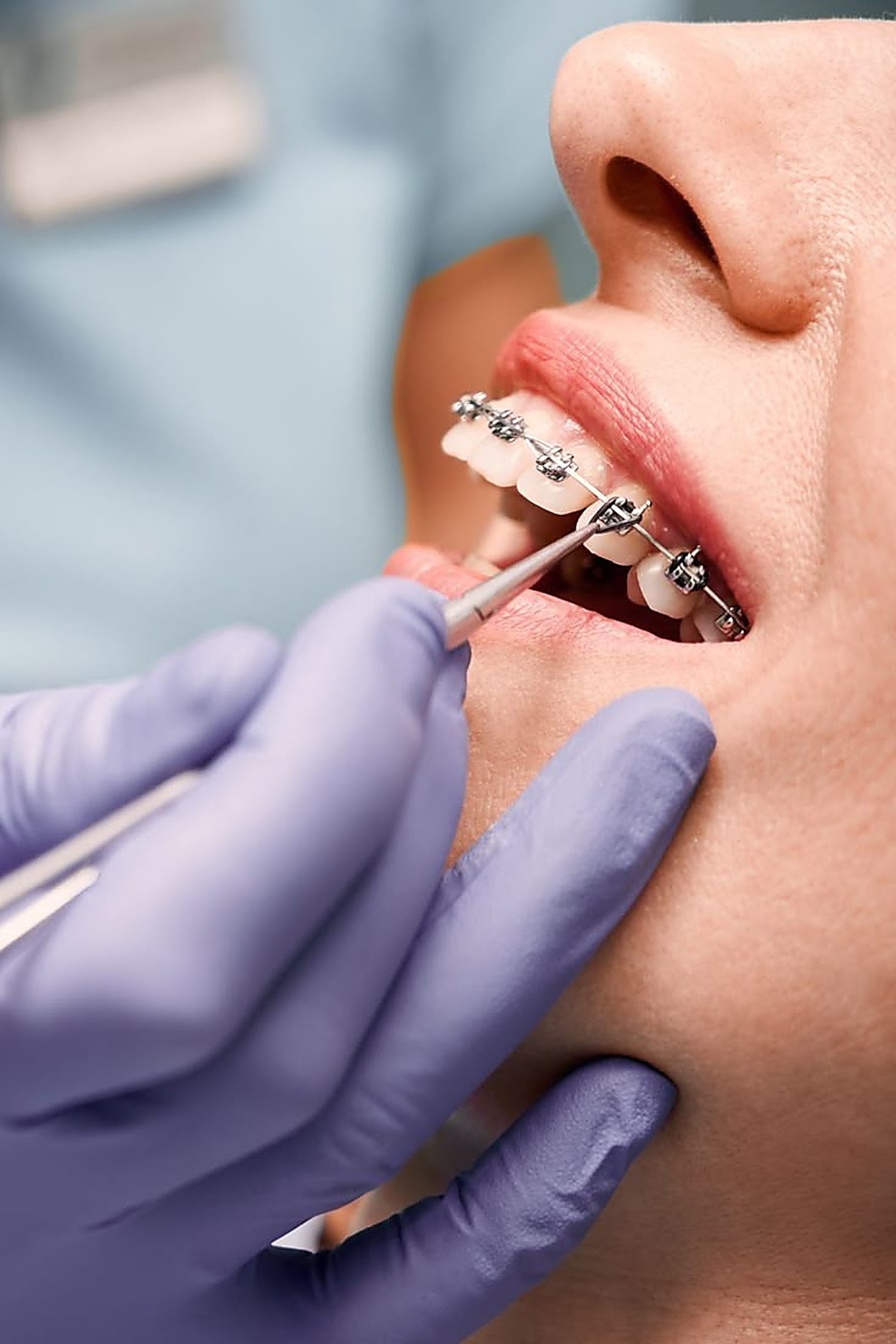 Dentist examining a patient at White Teeth Dental